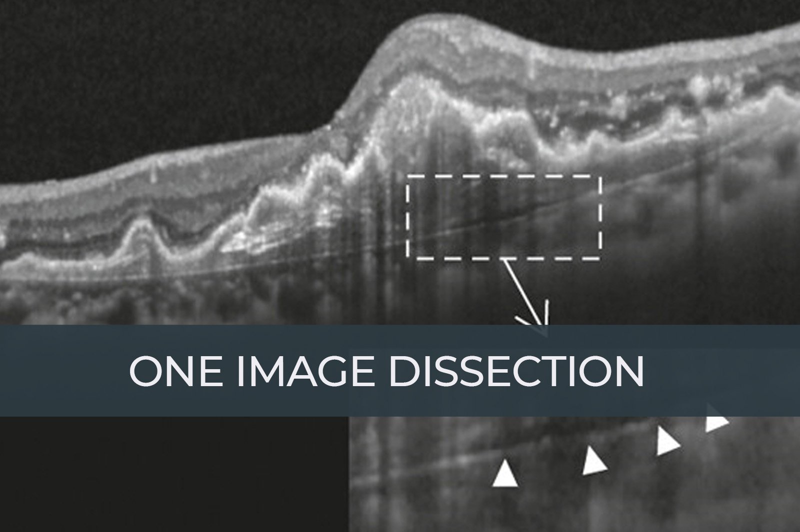 https://retinaimagingcongress.com/wp-content/uploads/2025/05/One-image-dissection.jpg