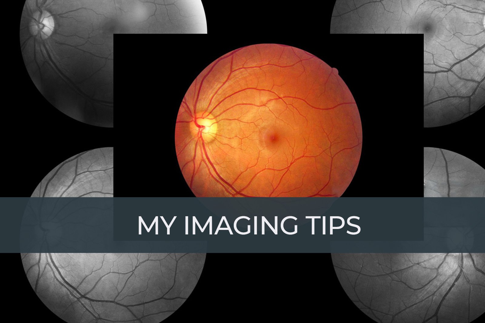 https://retinaimagingcongress.com/wp-content/uploads/2025/05/WHAT-I-DO-NEW-IN-IMAGING.jpg