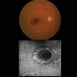 https://retinaimagingcongress.com/wp-content/uploads/2026/06/MINUTIA-MACULA-160x160.jpg
