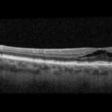 https://retinaimagingcongress.com/wp-content/uploads/2026/06/glossary-160x160.jpg