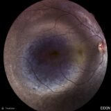 https://retinaimagingcongress.com/wp-content/uploads/2026/06/oncology-160x160.jpg