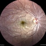 https://retinaimagingcongress.com/wp-content/uploads/2026/06/pamm-160x160.jpg